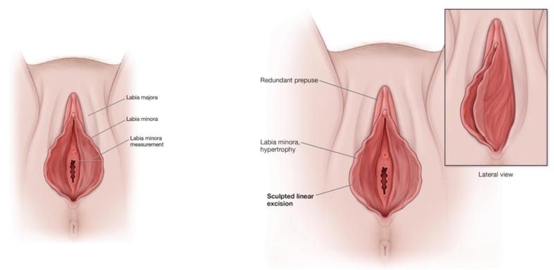 labia-cross-section